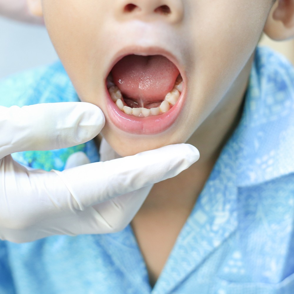 AdobeStock_281626595 v2 Girl showing of her clean teeth at the dentist for a preventive dental appointment in Franklin WI
